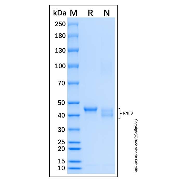 Recombinant Human RNF8 Protein -    by Aladdin Scientific