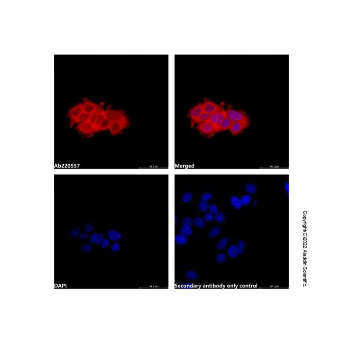 Recombinant Streptavidin Protein (LumiDye™ Yellow-Green 566) -    by Aladdin Scientific