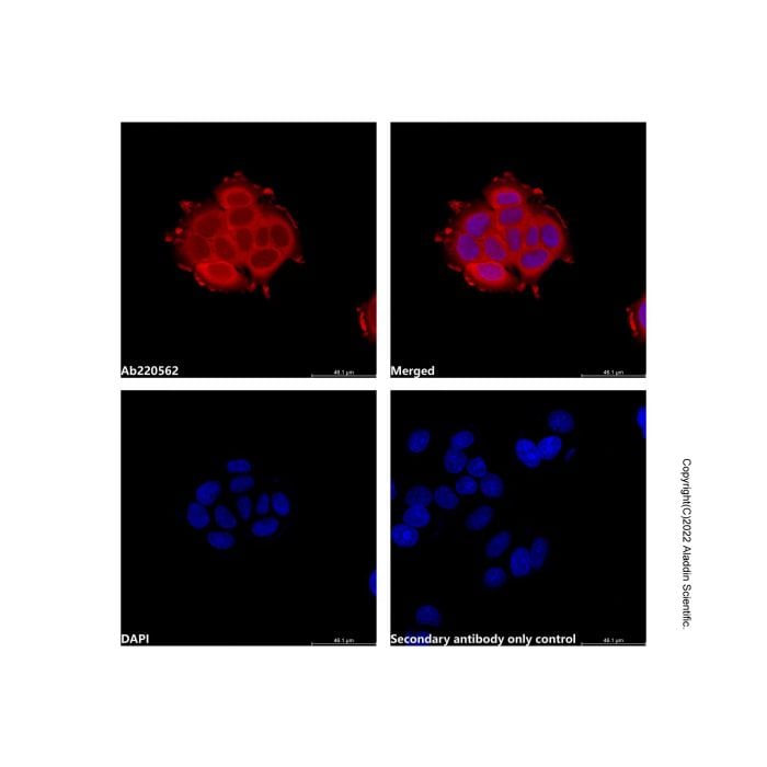 Recombinant Streptavidin Protein (LumiDye™ Yellow-Green 620) -    by Aladdin Scientific