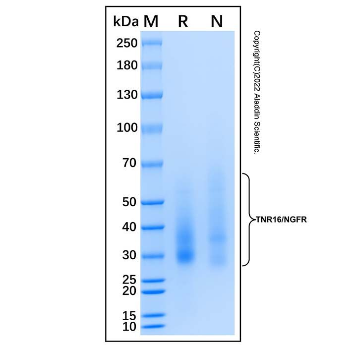 Recombinant Human NGFR/TNFRSF16 Protein -    by Aladdin Scientific