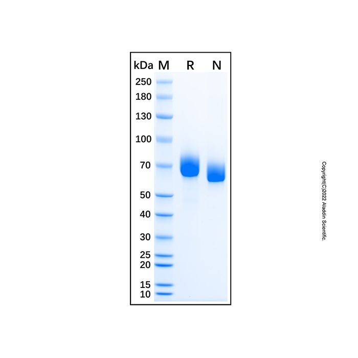 Recombinant Human FKBP9 Protein -    by Aladdin Scientific