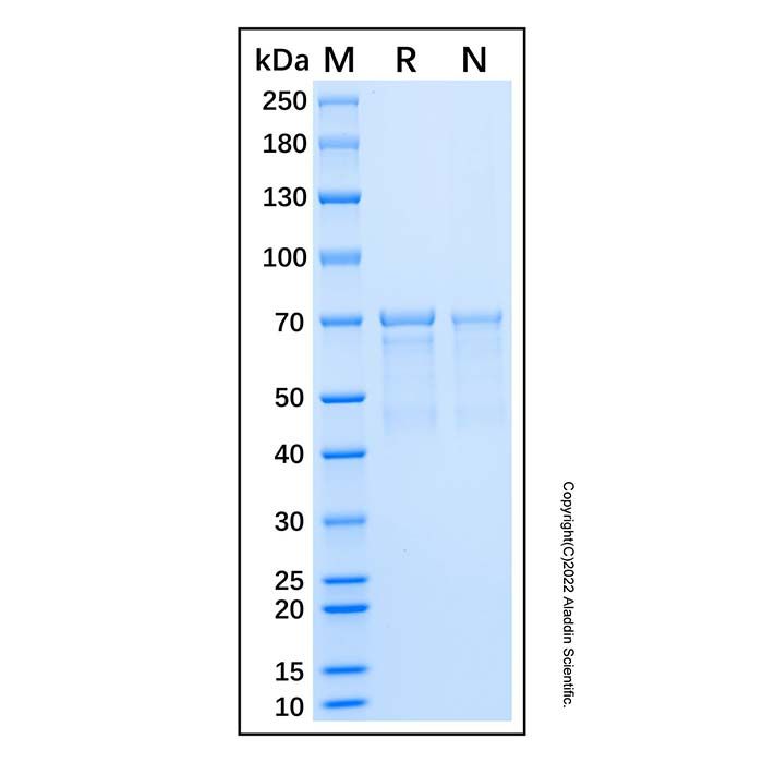 Recombinant Human AKT1 Protein -    by Aladdin Scientific