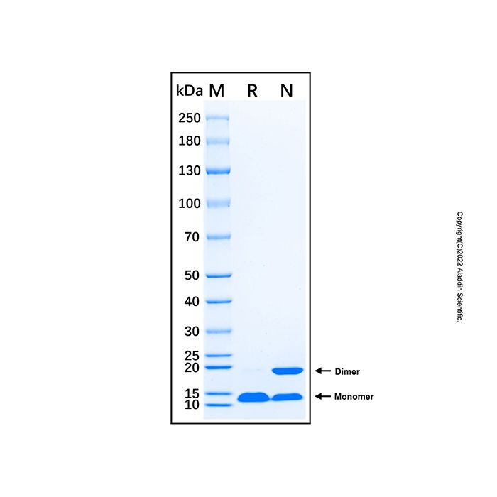Recombinant Human AQP4 Protein -    rp225004 by Aladdin Scientific