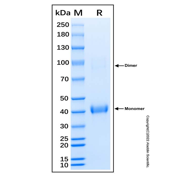 Recombinant Human RNF220 Protein -    by Aladdin Scientific