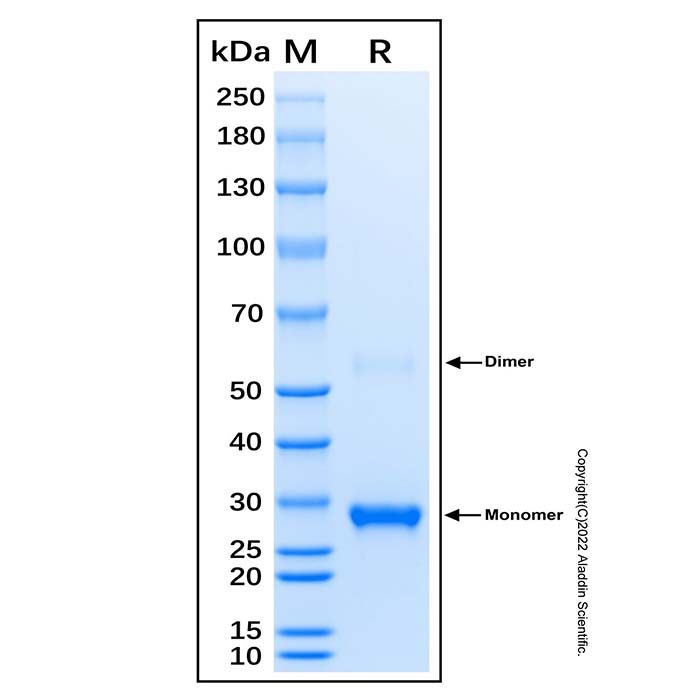 Recombinant Human KDM5B/PLU-1 Protein -    by Aladdin Scientific