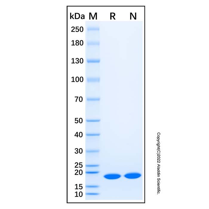 Recombinant Human IL-17E Protein -    by Aladdin Scientific