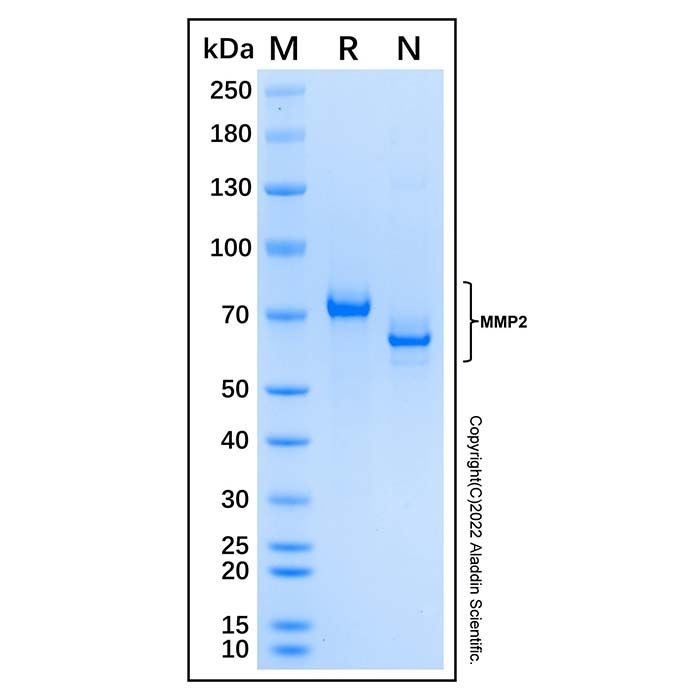 Recombinant Mouse MMP-2 Protein -    rp231178 by Aladdin Scientific
