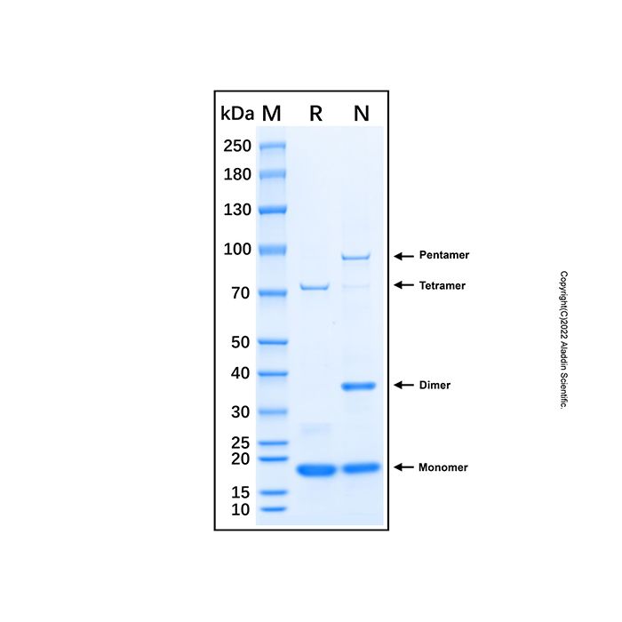 Recombinant Human RB1/OSRC Protein -    by Aladdin Scientific