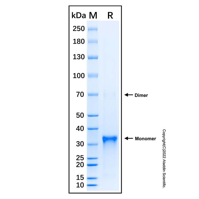 Recombinant Human CTGF/CCN2 Protein -    by Aladdin Scientific