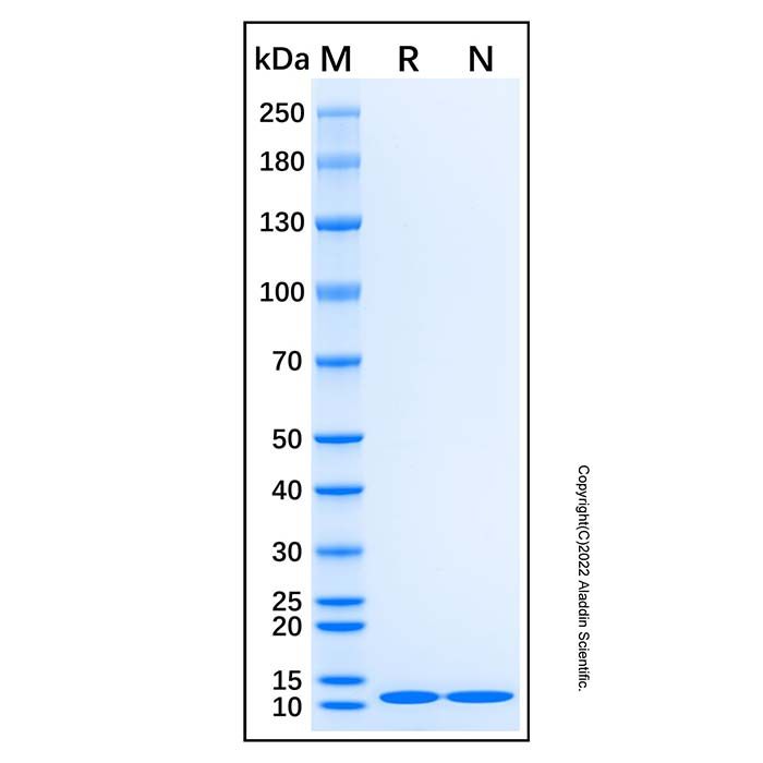 Recombinant Human SAA1 Protein -    rp301933 by Aladdin Scientific