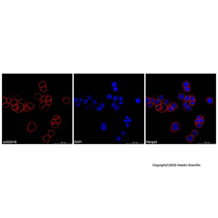 Recombinant Protein A/G (Cy3) -    by Aladdin Scientific