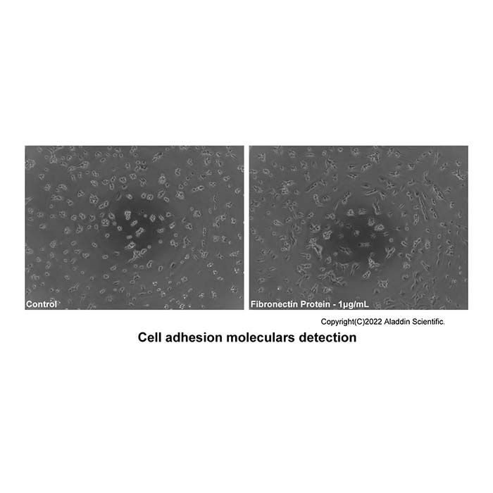 Recombinant Human Fibronectin Protein -    by Aladdin Scientific