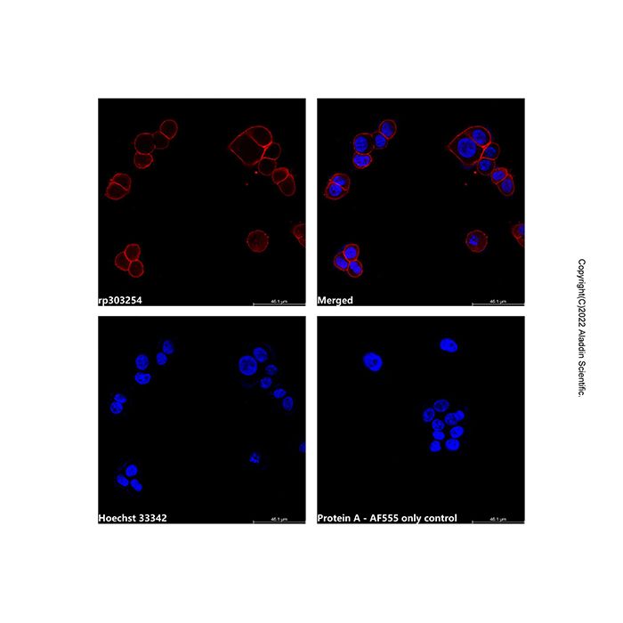 Recombinant Protein A, AF555 conjugate  -   CAS No(91932-65-9) by Aladdin Scientific