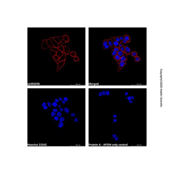 Recombinant Protein A, AF594 conjugate  -   CAS No(91932-65-9) by Aladdin Scientific