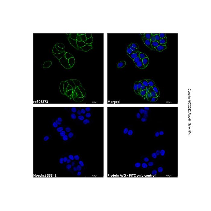 Recombinant Protein A/G, FITC conjugate -    rp303273 by Aladdin Scientific