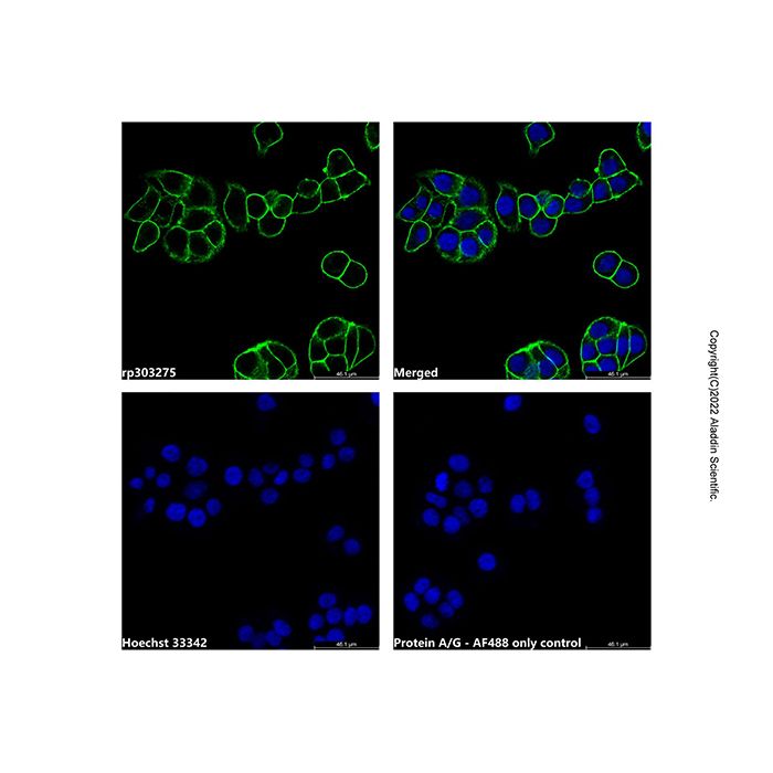 Recombinant Protein A/G, AF488 conjugate  -    rp303275 by Aladdin Scientific