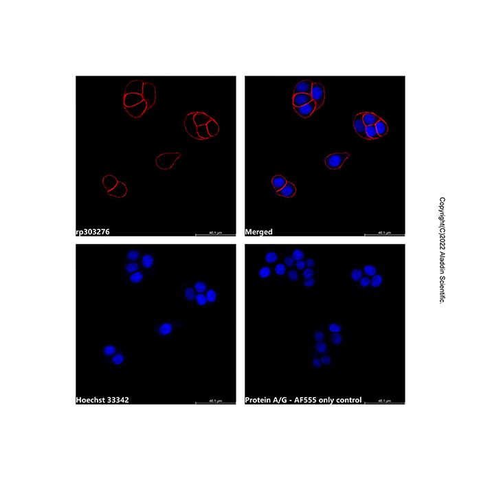 Recombinant Protein A/G, AF555 conjugate -    rp303276 by Aladdin Scientific