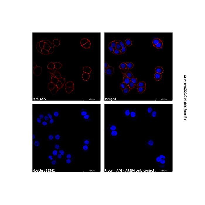 Recombinant Protein A/G, AF594 conjugate  -    rp303277 by Aladdin Scientific