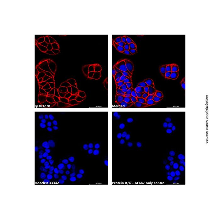 Recombinant Protein A/G,  AF647 conjugate -    rp303278 by Aladdin Scientific