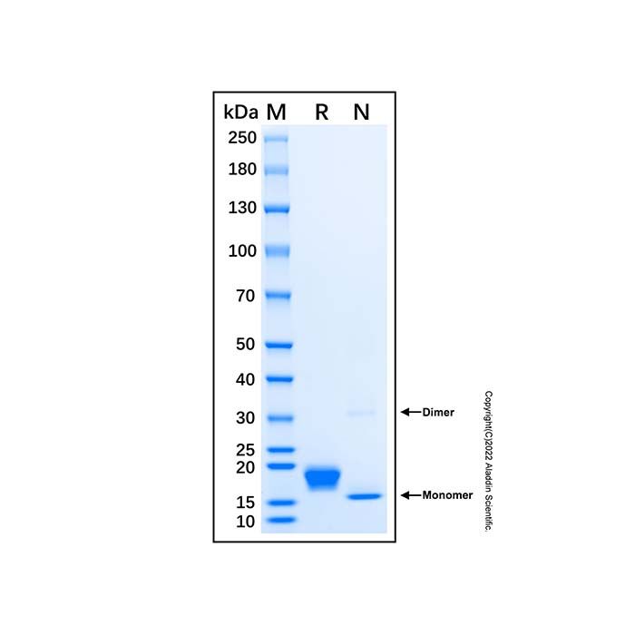 Recombinant Human IFN-alpha H2/IFNA14 Protein -    by Aladdin Scientific