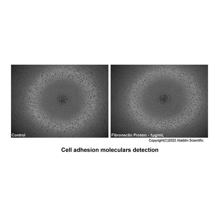 Recombinant Human Fibronectin Protein -    by Aladdin Scientific