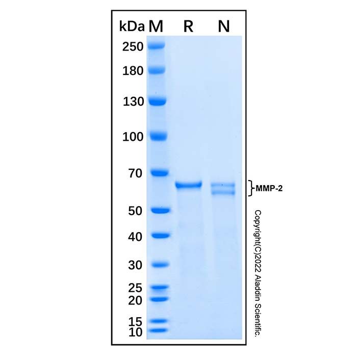 Recombinant Mouse MMP-2 Protein -    rp305421 by Aladdin Scientific