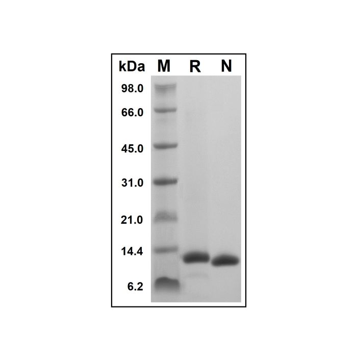 Recombinant Human Melanoma Inhibitory Activity Protein -    by Aladdin Scientific