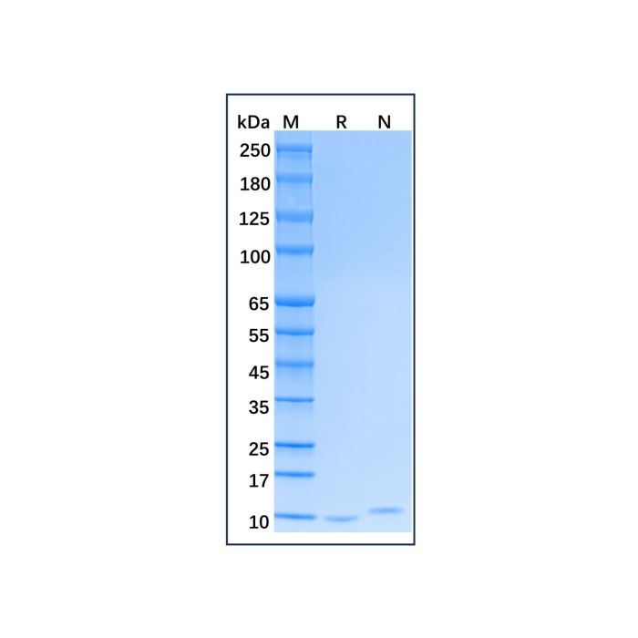 Recombinant Human CXCL5 Protein -    by Aladdin Scientific