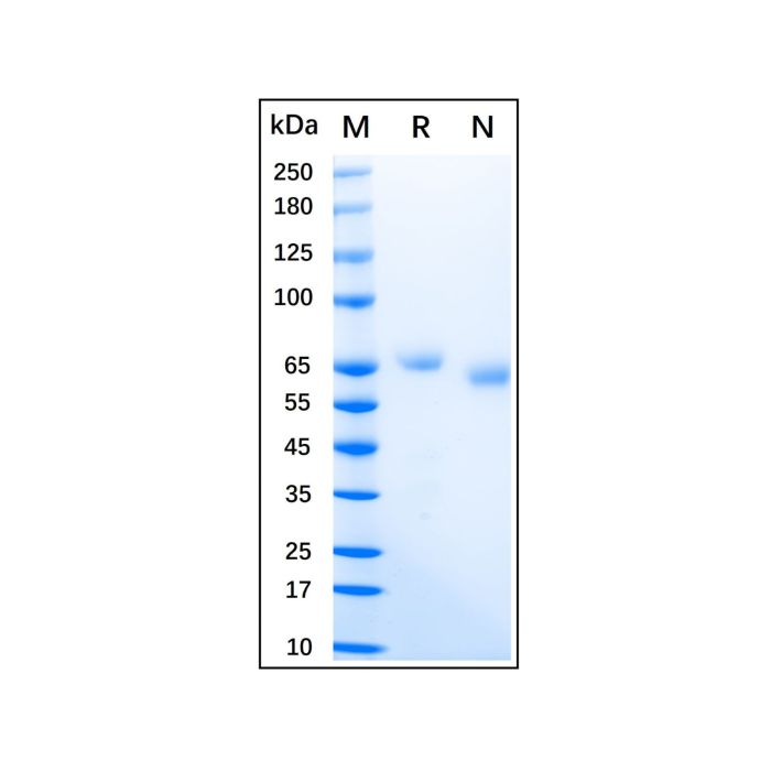 Recombinant Human IL-12 Protein -    by Aladdin Scientific