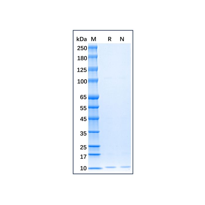 Recombinant Human SDF1 Protein -    by Aladdin Scientific