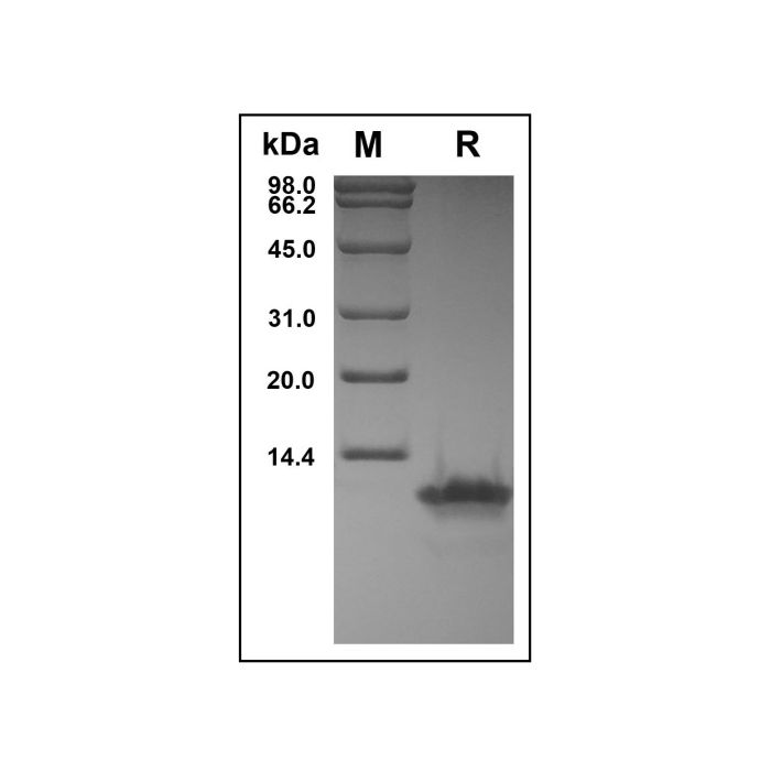 Recombinant Human CCL8/MCP-2 Protein -    by Aladdin Scientific