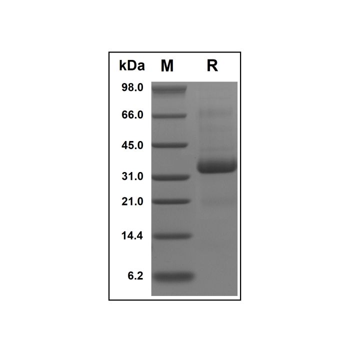 Recombinant Human SPARC Protein -    by Aladdin Scientific