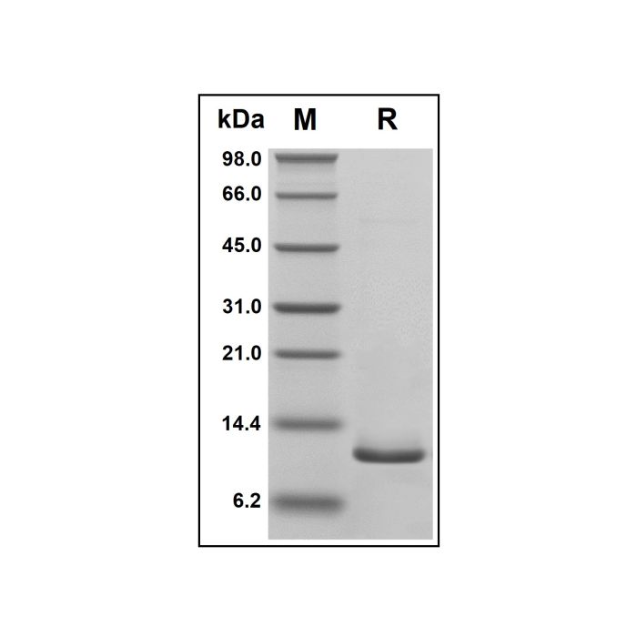 Recombinant Human TFF2 Protein -    by Aladdin Scientific