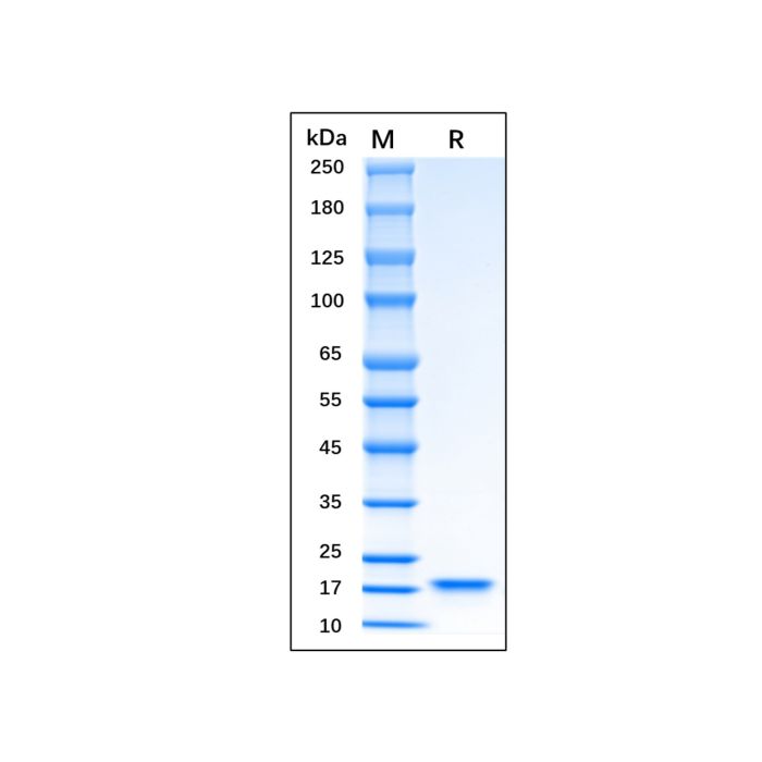 Recombinant Human KGF/FGF-7 Protein -    by Aladdin Scientific