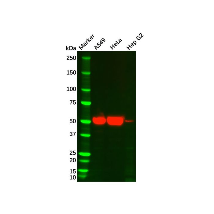 Cytokeratin 7 Mouse mAb - by Aladdin Scientific
