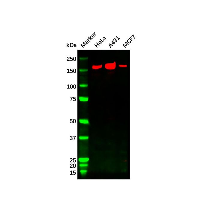 ErbB2/Her2 Mouse mAb -    by Aladdin Scientific