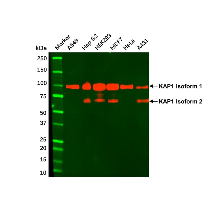 KAP1 Mouse mAb -    by Aladdin Scientific