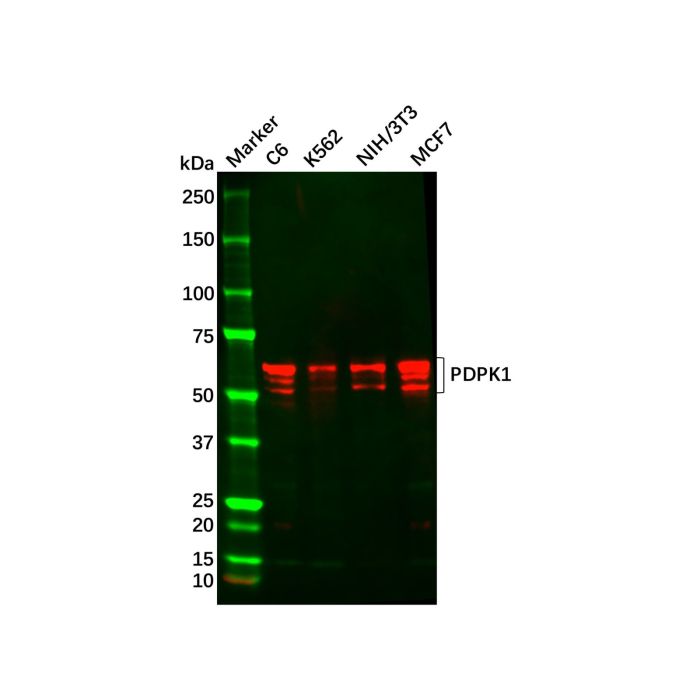 PDPK1 Mouse mAb -    by Aladdin Scientific