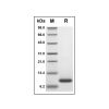 Recombinant Human Eotaxin 2 Protein - by