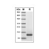 Recombinant Human CCL11/Eotaxin Protein - by