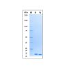 Recombinant Human GM-CSF Protein - by