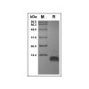 Recombinant Human MDC Protein - by