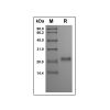Recombinant Human Osteoprotegerin Protein -    by