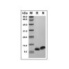 Recombinant Human RANTES Protein - by