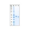 Recombinant Human TNF RII/TNFRSF1B Protein