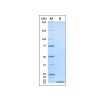 Recombinant Human EGF Protein