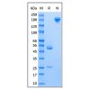 Mouse Anti-Human IgE epsilon chain Antibody - by