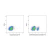 Divozilimab (anti-CD20)