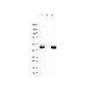 Recombinant Cytokeratin 18 Antibody