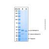 Recombinant Human Cathepsin S protein